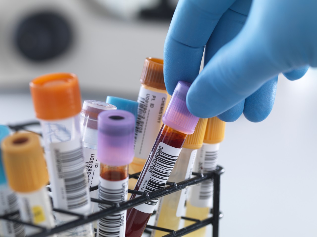 一致性评价大幕开启，，医院市场即将调解