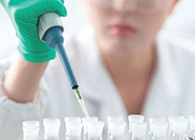 Science子刊：一种新模子可展望微粒制剂的可注射性