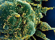 唾液检测新冠抗体新要领来了，，，，获取效果仅需几小时！