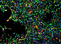 天下首创：药物将干细胞指导至受损部位，，，，提高其愈合能力！