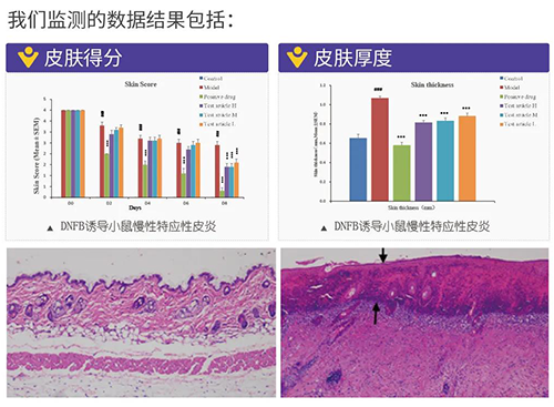 yl23455永利建设的特应性皮炎及湿疹模子监测数据效果