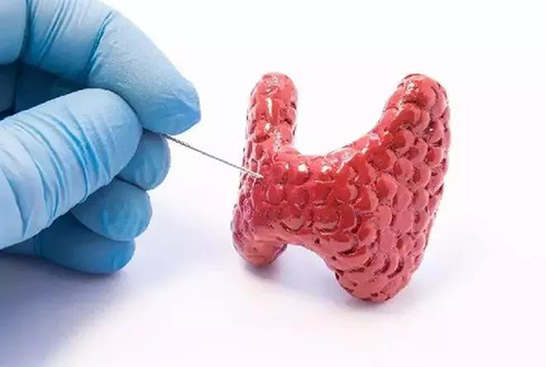 甲状腺疾。。，，，，包括甲状腺功效减退和甲状腺功效亢进，，，，，自古以来就是重复被医学研究职员研究的疾病