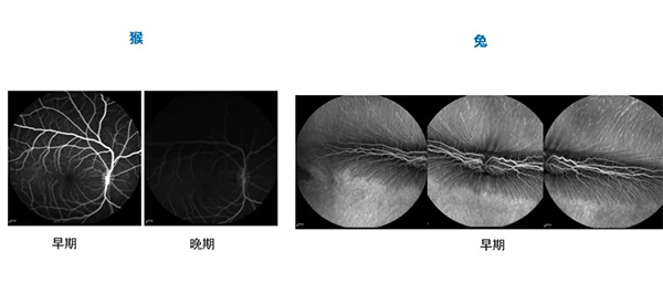 差别时期的眼底荧光造影（FA）.jpg